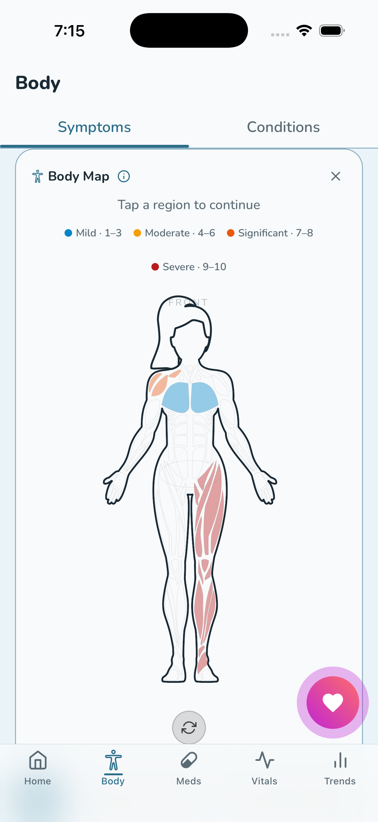 Tralo body map showing symptom locations color-coded by severity